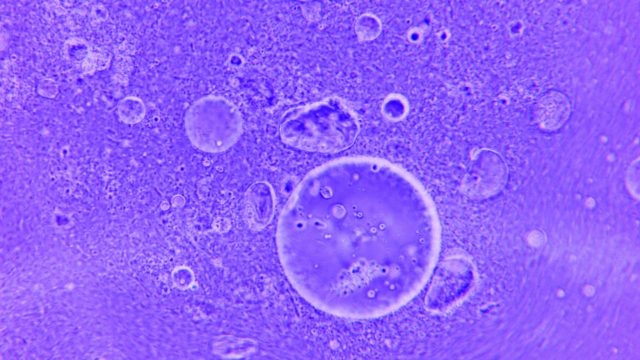 Fluorescencia celular